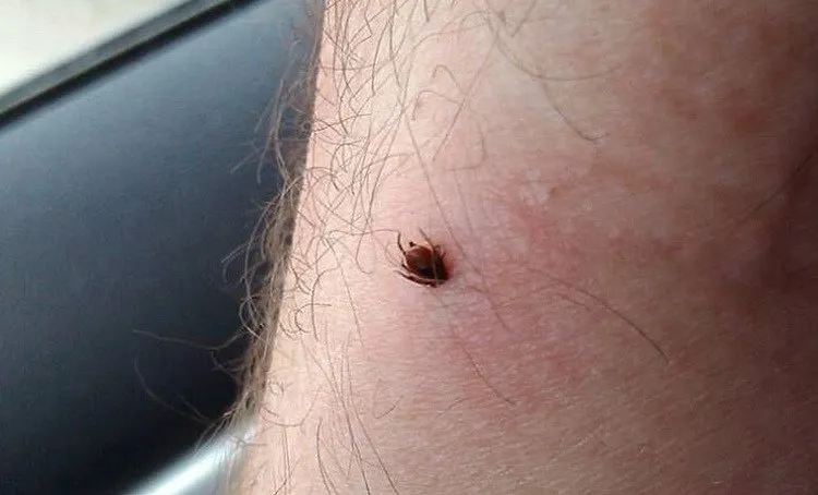 Более 100 детей пострадали от укусов клещей за теплый период в ЕАО