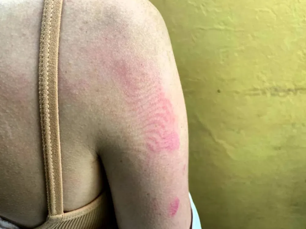 В наркодурмане избил кочергой сожительницу житель ЕАО