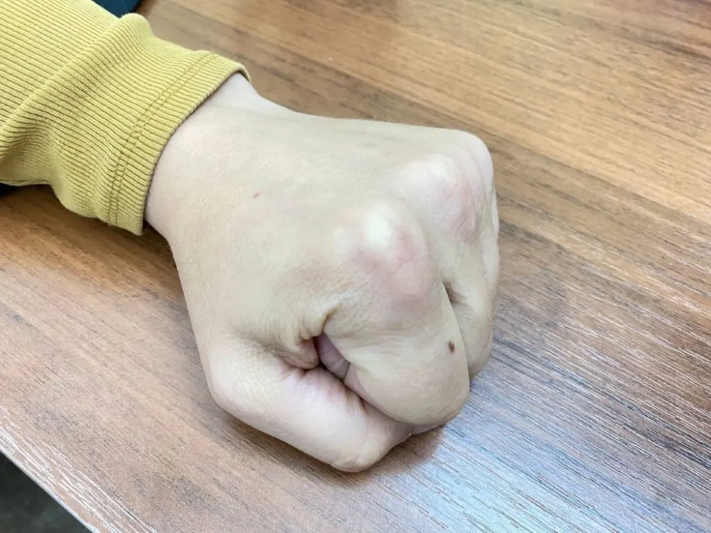 Житель ЕАО ответит за сломанную челюсть своей знакомой