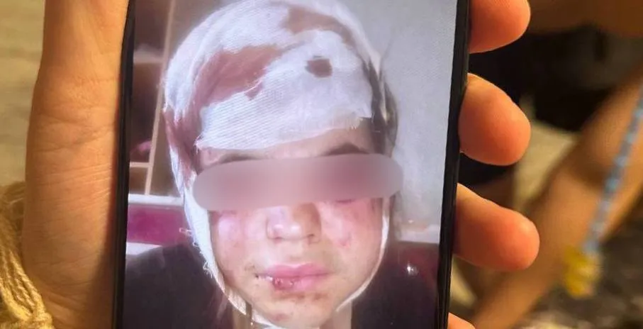 Напали на женщину и жестоко ее избили две девочки-подростка в Биробиджане