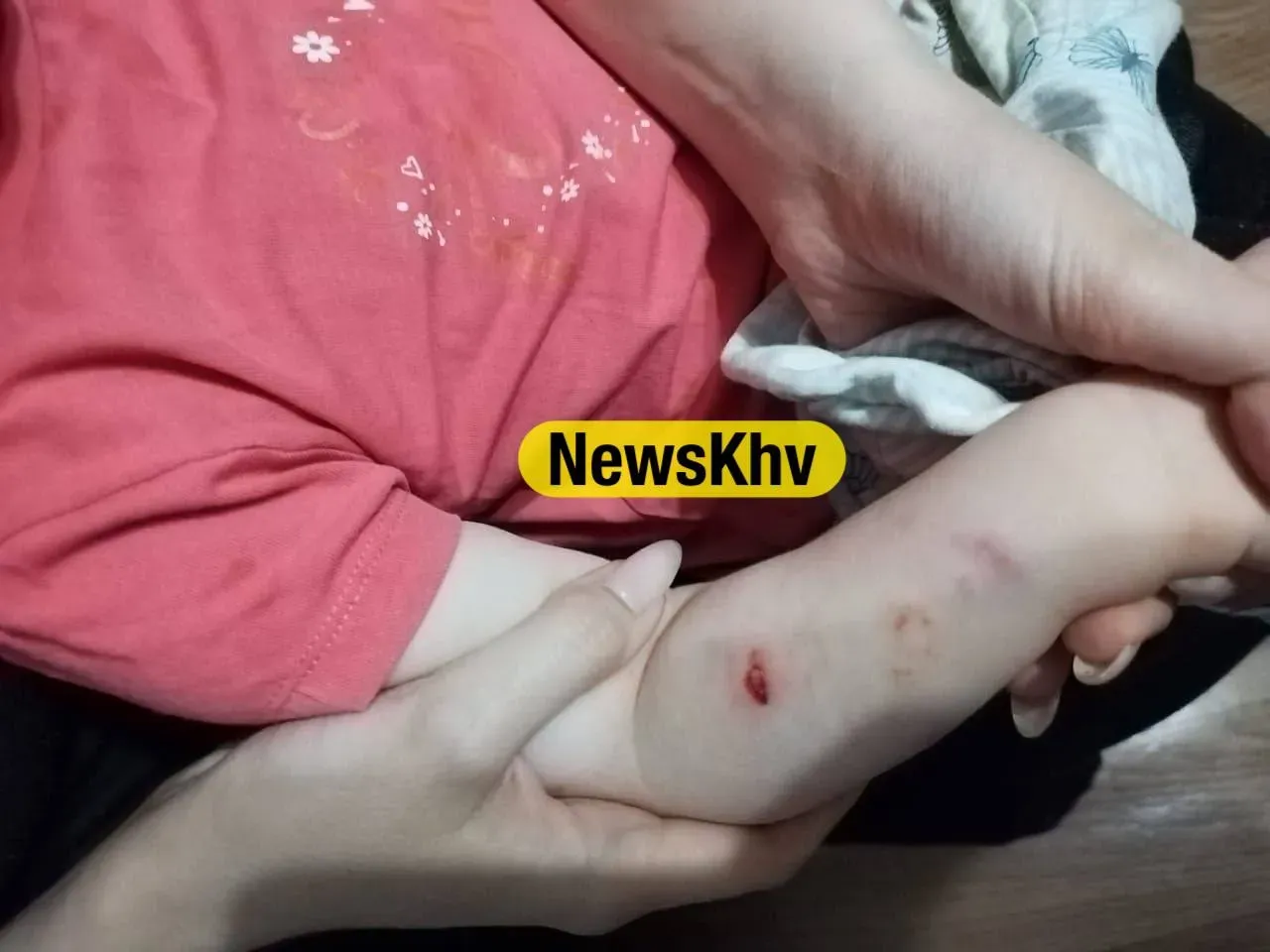 Двухгодовалого ребенка искусала стая уличных собак в Хабаровске
